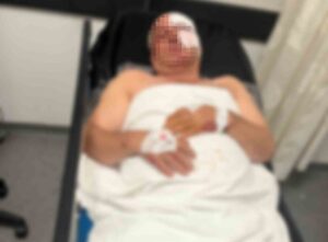 Motosiklet kazasında yaralandı, kardeşinin çarptığını iddia etti